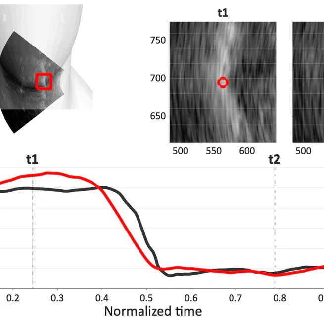 Laryngeal Elevation in Native and Non-native Lexical Tone Production