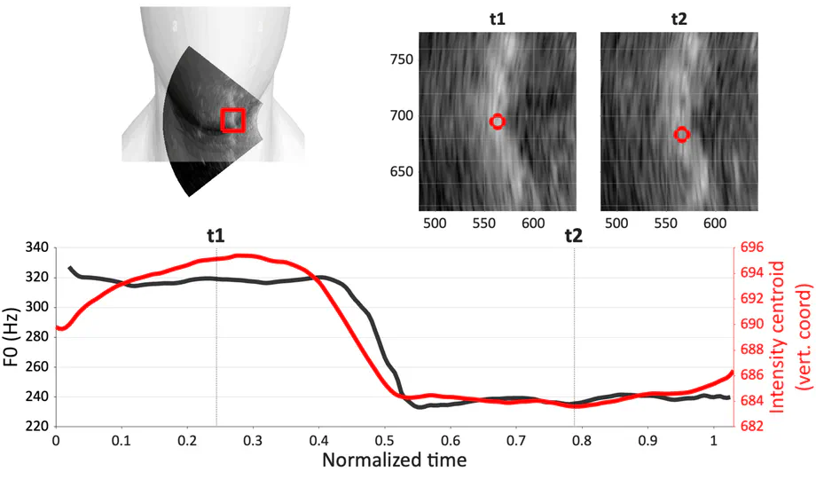 Laryngeal Elevation in Native and Non-native Lexical Tone Production